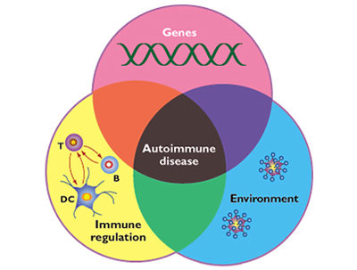 Autoimmuunisairaudet ja patofysiologiset mekanismit: hoito ravinnolla sekä stressinhallinnalla
